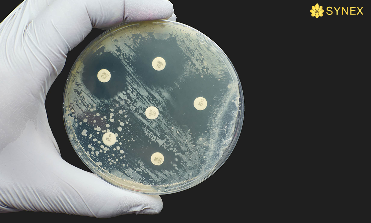 Kiem dinh vai khang khuan iso 20645