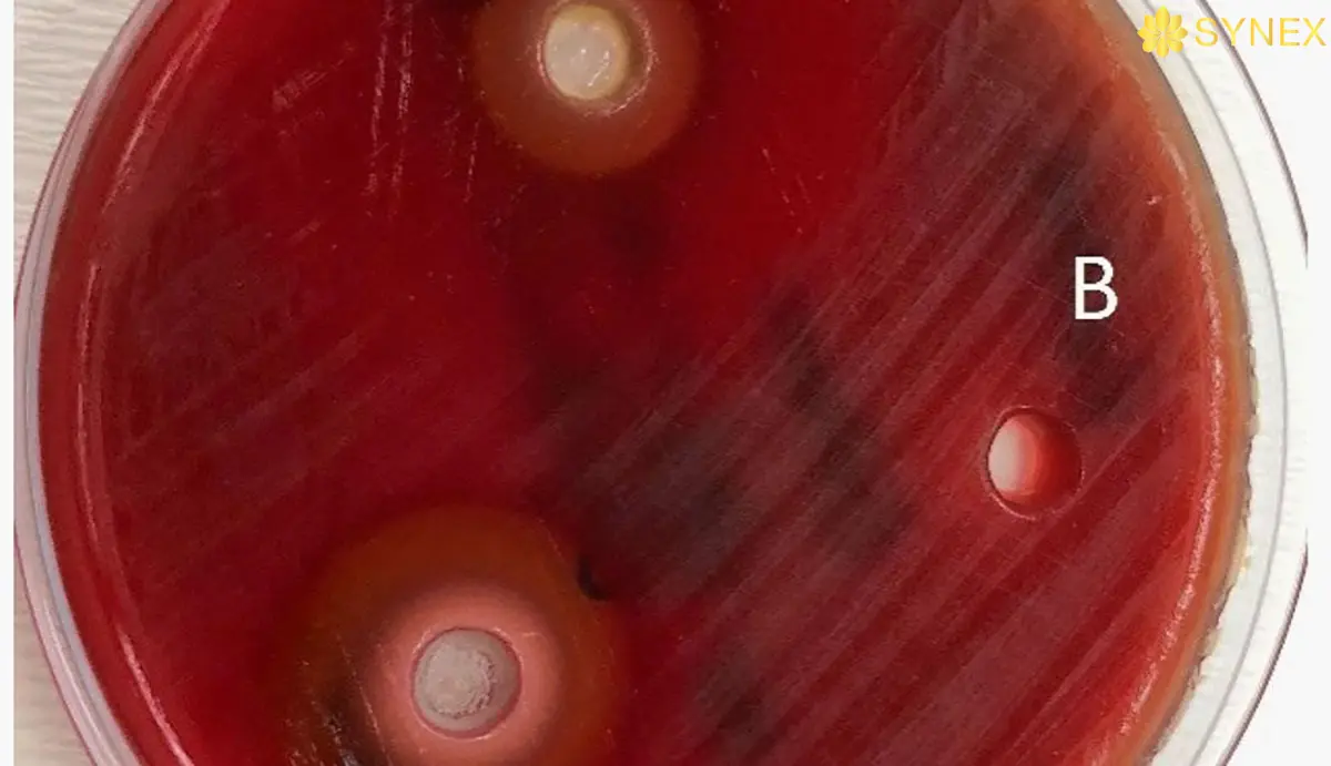 Thu nghiem tam khuech tan thach